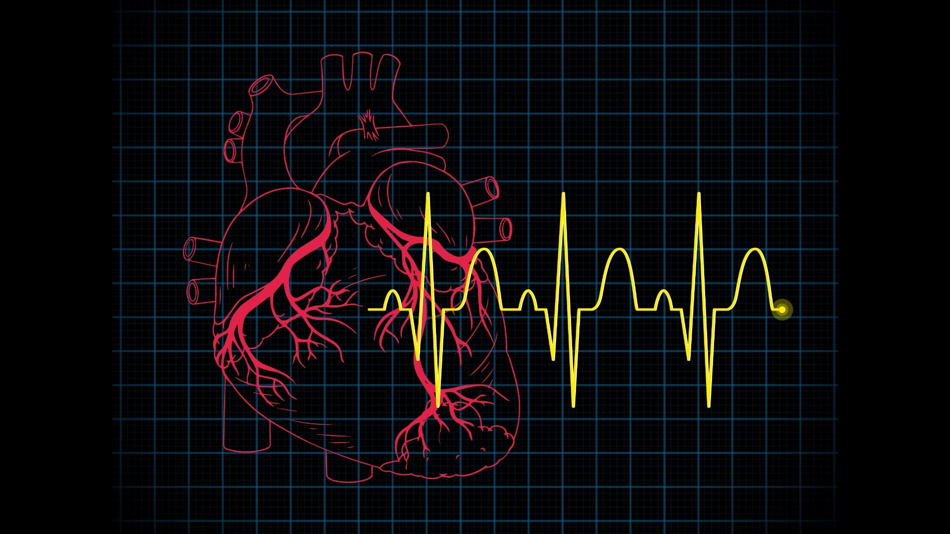 Defibrillator Voltage How It Works in Life-Saving Cardiac Resuscitation | AED Best Brands